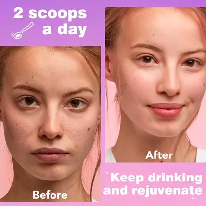 Multi Collagen Peptidos